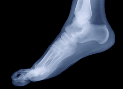 Chicago Foot & Ankle Disorders